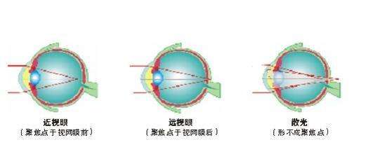 滨州验光师培训学校