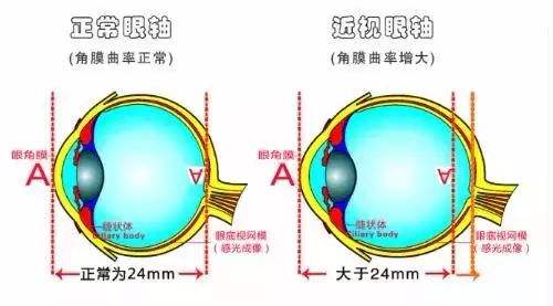 潍坊验光师培训学校分享测试假性近视的三种方法