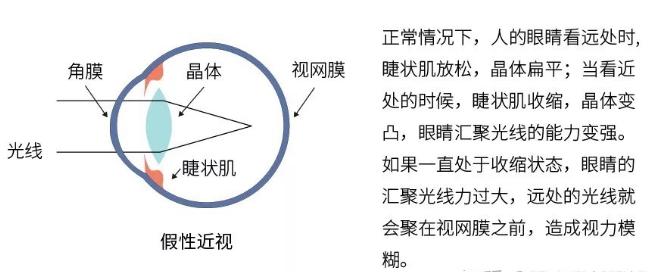 验光师培训学校，正真视光学院