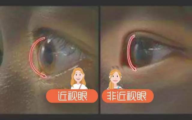 验光师培训学校，正真视光学院