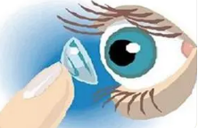 角膜接触镜相关性眼干燥的处理方法
