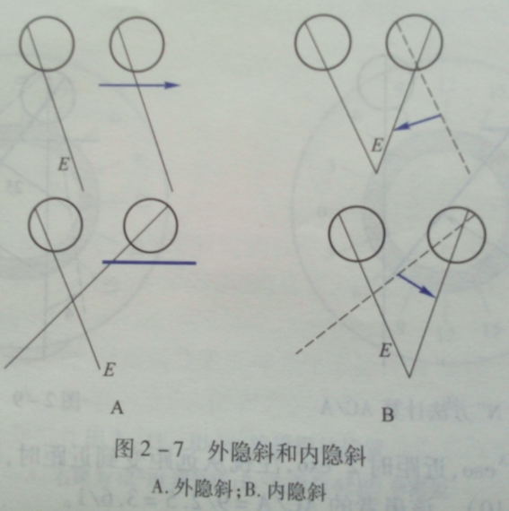 泰安验光师分享隐斜的概念和意义